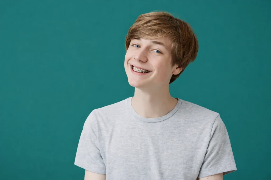 Before and after Fastbraces results at Smile Rite Dental Houston TX