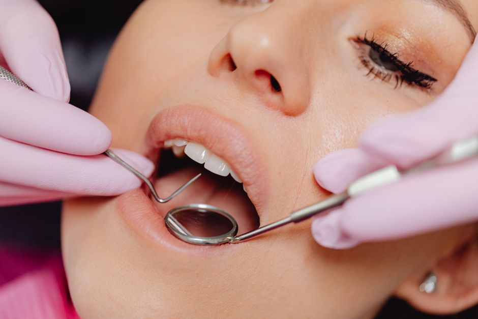 Dental Cleaning