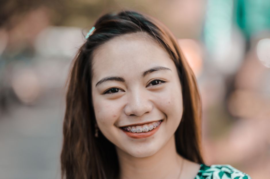 Invisalign for bite correction