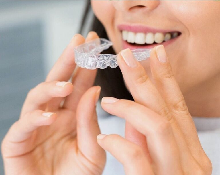 Invisalign for bite correction