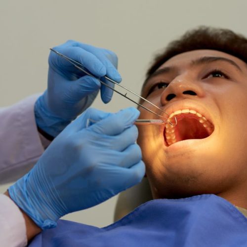 Root Canal
