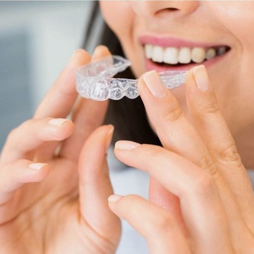 Invisalign for bite correction